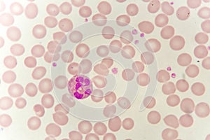 Neutrophil cell photo