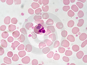 Neutrophil cells