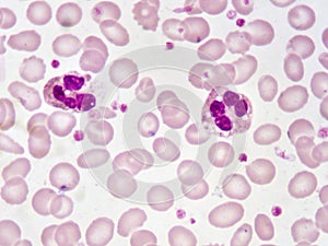 Neutrophil cells photo