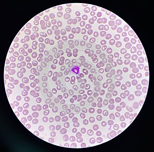 Neutrophil donut shape on rbc background photo