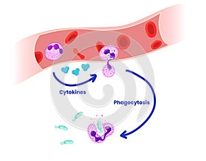 Neutrophils phagocytosis of bacteria stages