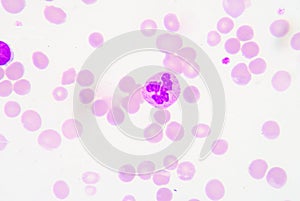 Neutrophils