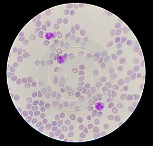 Neutropil with toxic granulation on red blood cells background