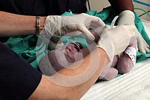 Doctor tagging new born baby