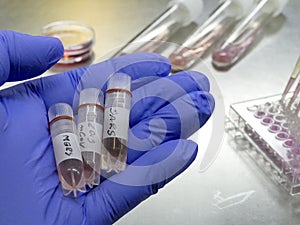 New coronavirus 2019-nCoV in laboratory