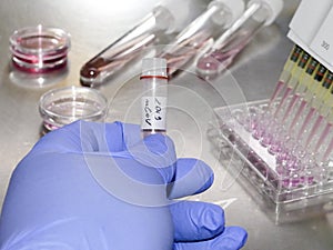 New coronavirus 2019-nCoV in laboratory
