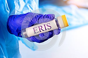 New infectious Eris variant of covid disease (EG.5) sample in lab tube in the scientist hand in blue medical glove