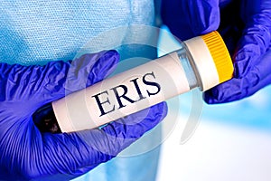 New infectious Eris variant of covid disease (EG.5) sample in lab tube in the scientist hand in blue medical glove photo