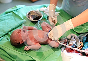 Newborn baby after birth in hospital