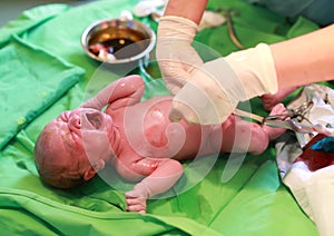 Newborn baby after birth