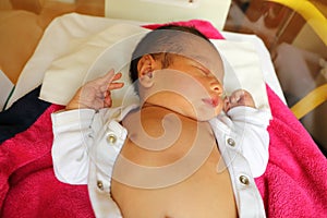 Newborn baby boy with jaundice