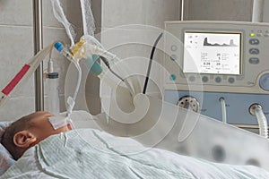 Newborn baby on breathing machine in neonatal intensive care unit photo
