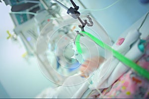 Newborn baby connected to the life support equipment in the NICU