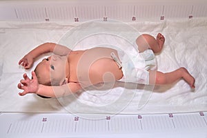 A newborn baby in diapers on a white changing table with a ruler with a Moro reflex photo