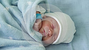 Newborn Baby Face Portrait Acne Allergic Irritations Early Days Sleeping On Blue Background. Child At Start Minutes Of