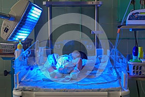 Newborn baby with hyperbilirubinemia under blue UV light for phototheraphy