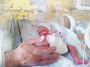 Newborn baby in an incubator