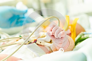 newborn baby in incubator at neonatal resuscitation center