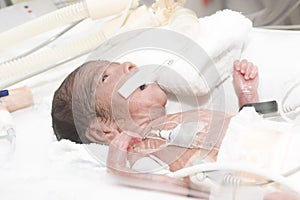 Newborn baby inside incubator