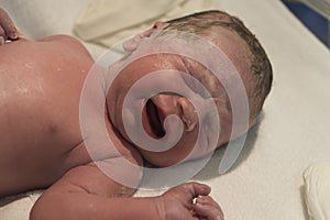 Newborn baby in postpartum crib still covered in vertix caseosa and with prophylactic ointment to avoid conjunctivitis