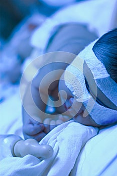 Newborn baby under ultraviolet light