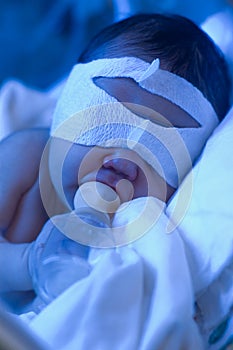 Newborn baby under ultraviolet light