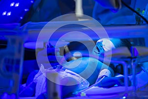 Newborn child baby having a treatment for jaundice under ultraviolet light in incubator