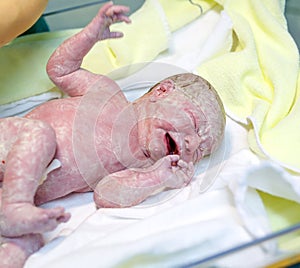 Newborn child seconds and minutes after birth.