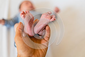 Newborn feet skinning held by mommy