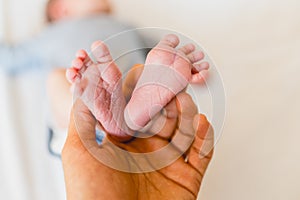 Newborn feet skinning held by mommy