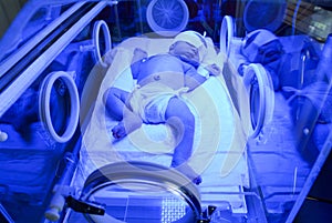 Newborn having a treatment for jaundice under ultraviolet light