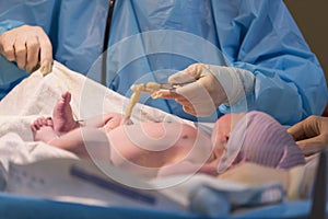 Newborn male baby ready for umbilical cord to be cut