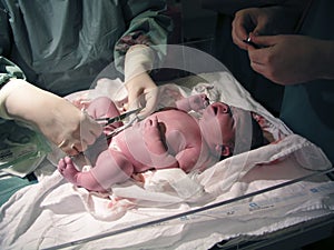Newborn-Medical examination img