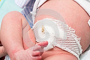 Newborn navel healthcare