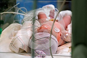 Newborn Through NICU Glass photo