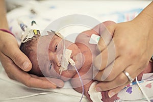 Newborn premature baby in the NICU intensive care photo