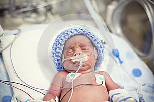 Newborn premature baby in the NICU intensive care photo