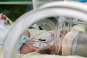 Newborn sick baby in an incubator