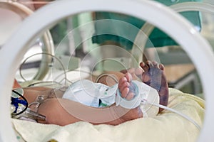 Newborn sick baby in an incubator