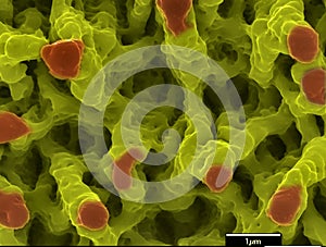 Nickel microstructures done by short laser pulse