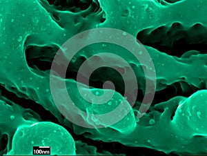 Nickel nanostructures grown by short laser pulses photo