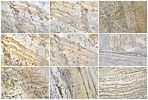 Nine Natural Limestone Background or textures