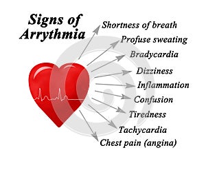 Nine Sign of Arrythmia