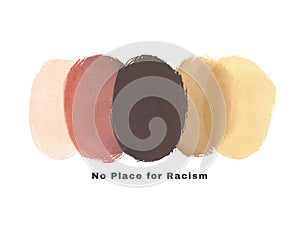 No place for racism