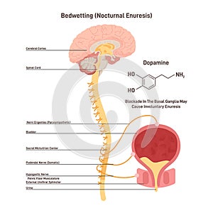 Nocturnal enuresis or bedwetting. Involuntary urination in adulthood