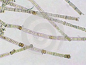 Nodularia sp. toxic algae under microscopic view, nitrogen-fixing cyanobacteria, cyanotoxin, harmful to humans, x40