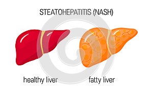 Non-alcoholic steatohepatitis concept