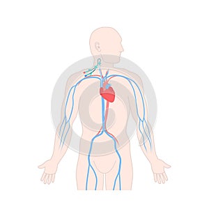 Central venous catheter in the jugular vein photo