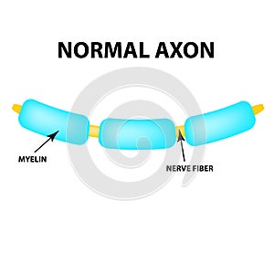 Normal axon. Healthy myelin. World Multiple Sclerosis Day. Infographics. Vector illustration on isolated background. photo