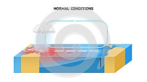 Normal Conditions In The Equatorial Pacific Ocean photo